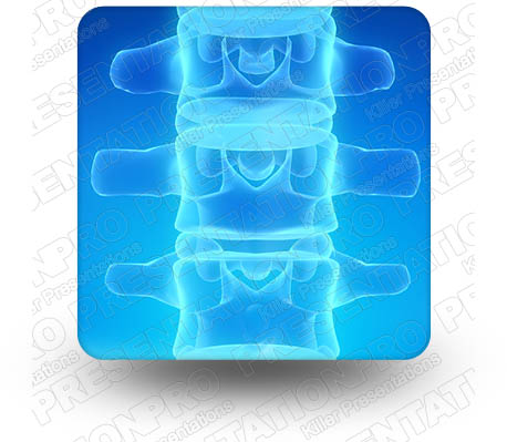 Anatomy Spine 01 Square PPT PowerPoint Image Picture